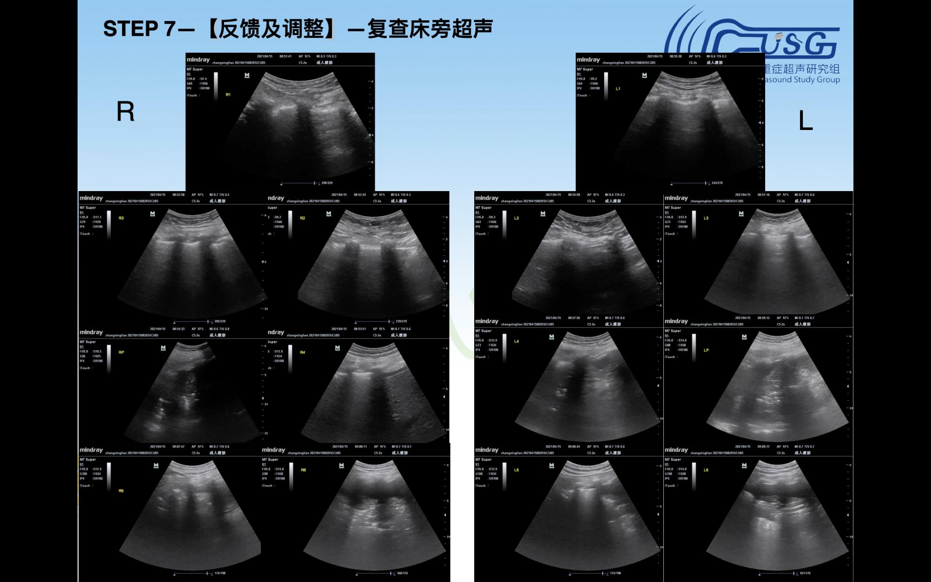 重症医学科协办四川省第十期重症超声培训会暨CCUSG重症超声巡回培训成都站基础班（宜宾分会场）圆满成功