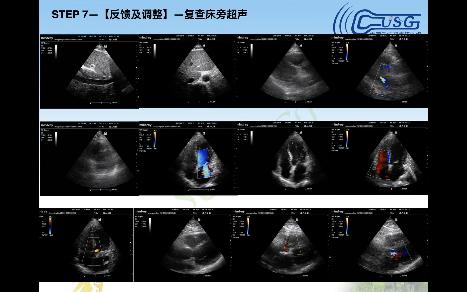 重症医学科协办四川省第十期重症超声培训会暨CCUSG重症超声巡回培训成都站基础班（宜宾分会场）圆满成功