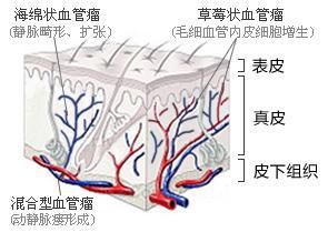 “瘤”你“核”用